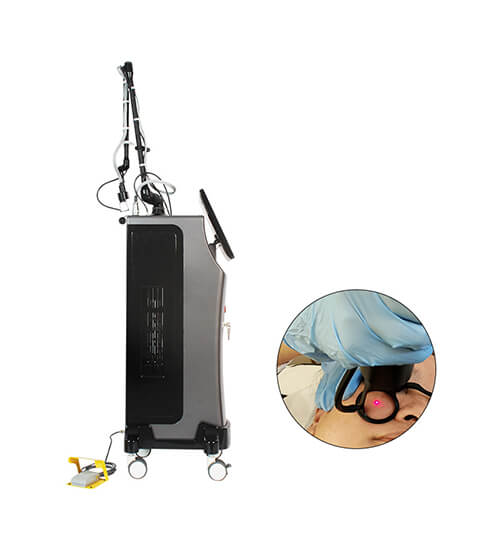 Vertical Láser Co2 Fraccional con Vaginal MK-605